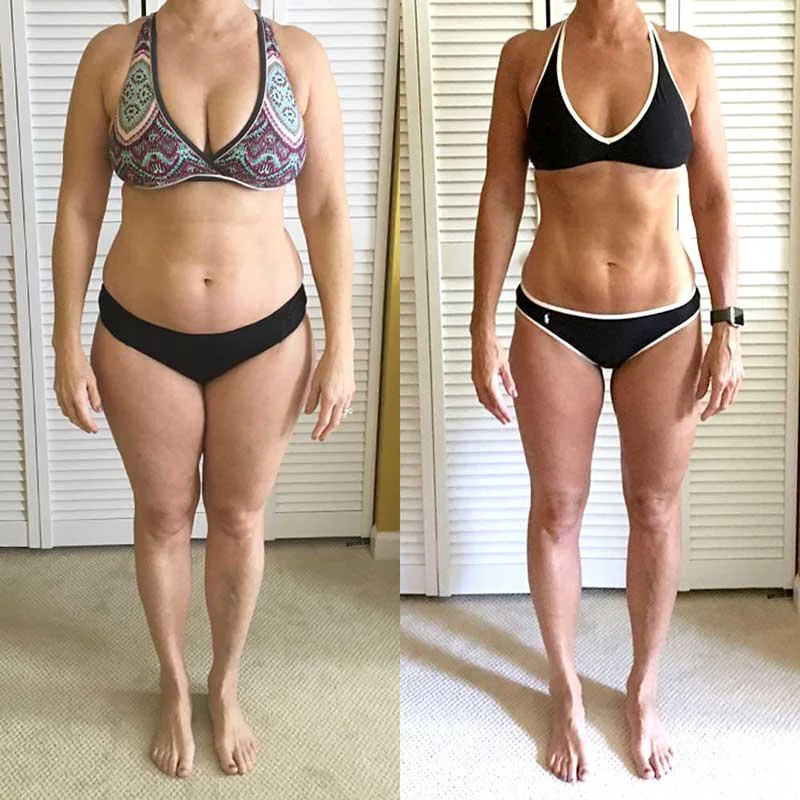 Before and after on retatrutide — Rachel, 47 · Surrey, −18 kg in 12 months