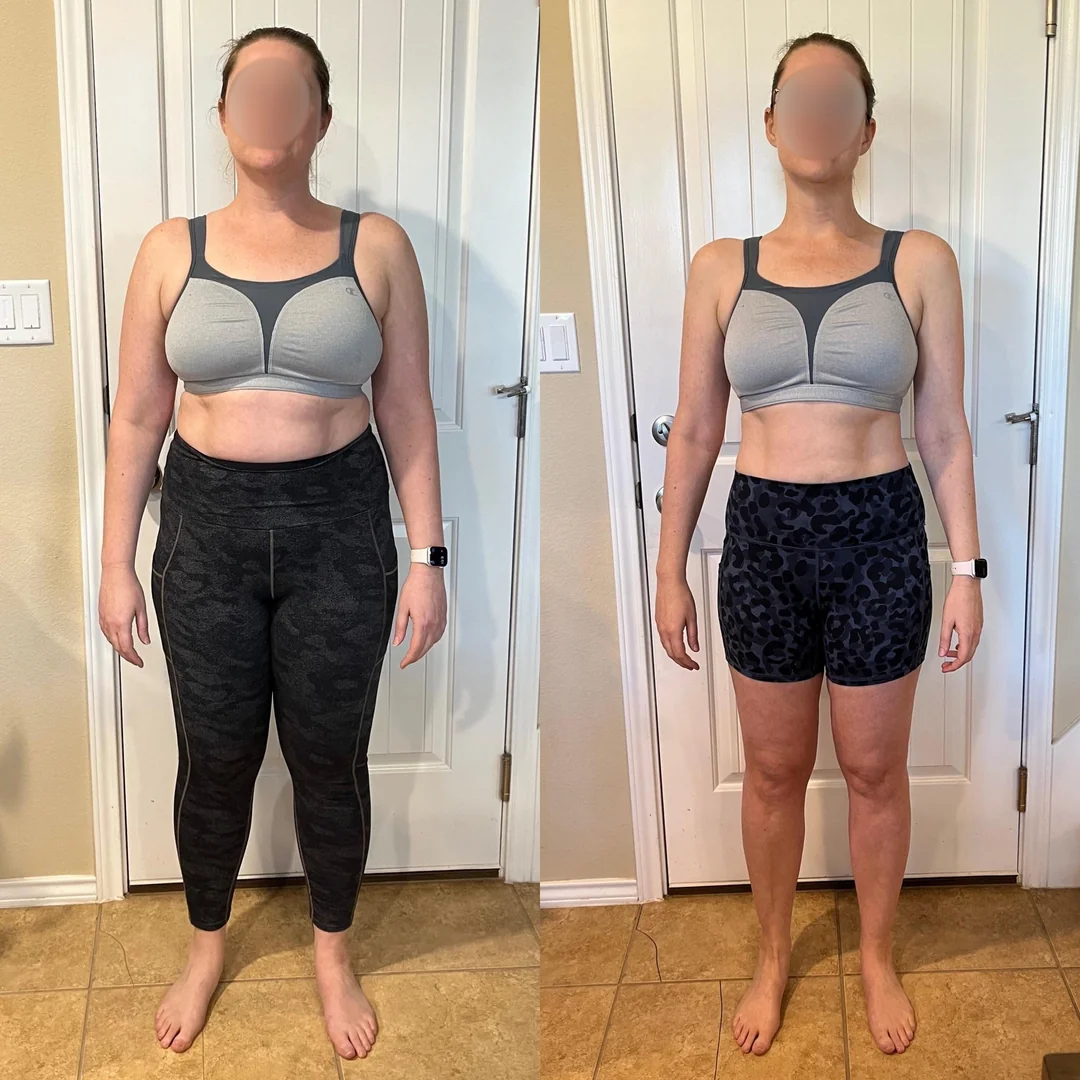 Before and after on retatrutide — Anna, 41 · Glasgow, Reached goal in 7 months